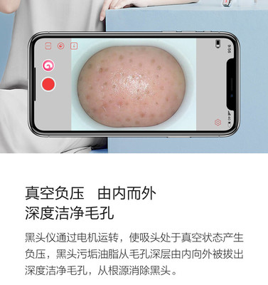 小米有品媄拾智能可視吸黑頭儀 告別黑頭，開啟“眼見為實”的清潔新時代